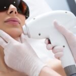 laser hair removal