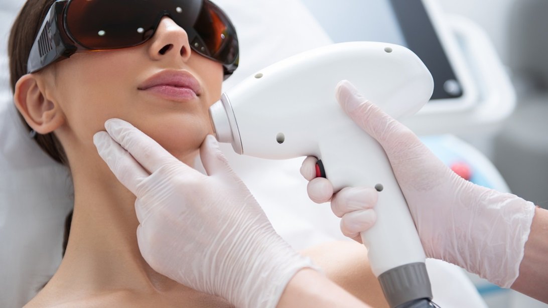 Hormonal Havoc? How Unwanted Hair Growth Can Be Managed with Laser Hair Removal