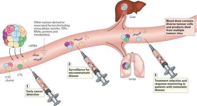 Liquid Biopsy: Detecting, Tracking, and Treating Cancer with Blood DNA