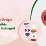 Homeopathic Treatment